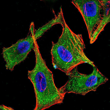 TIE1 Antibody