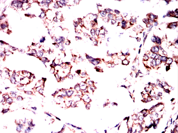 TIE1 Antibody