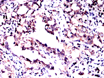 TIE1 Antibody