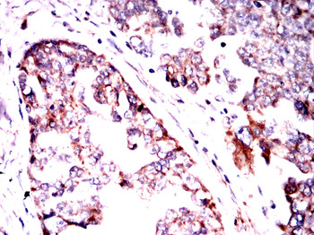 TIE1 Antibody