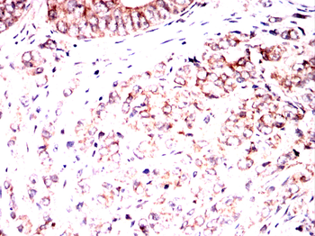 TIE1 Antibody