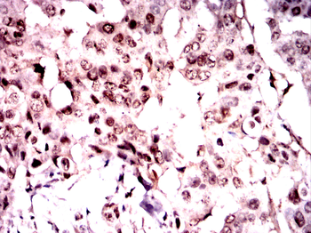 GCK Antibody