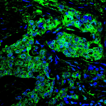 GCK Antibody