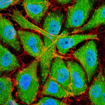 FCER1A Antibody