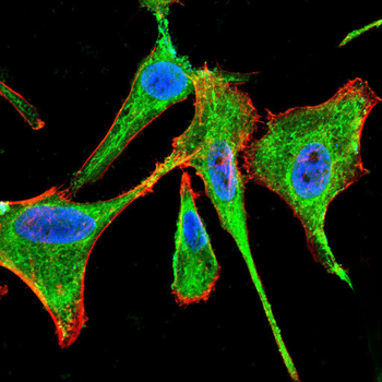 FCER1A Antibody