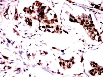 GAB2 Antibody