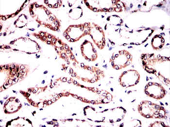 GAB2 Antibody