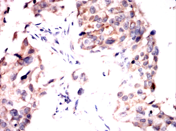 GAB2 Antibody