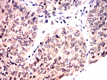 GAB2 Antibody