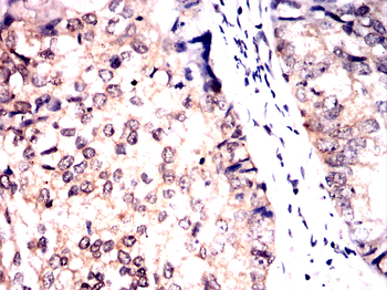 GAB2 Antibody