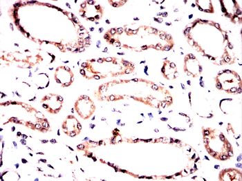 GAB2 Antibody