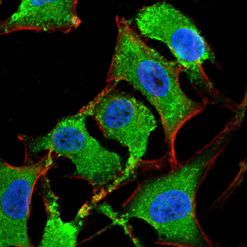 FSHB Antibody