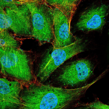 DAPK3 Antibody