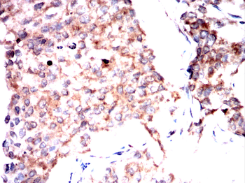 DAPK3 Antibody