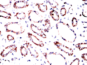 DAPK3 Antibody