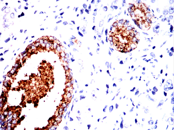 DAPK3 Antibody