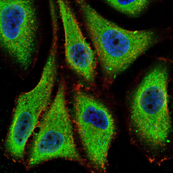 B3GALT4 Antibody
