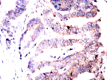 B3GALT4 Antibody