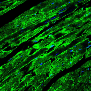 B3GALT4 Antibody