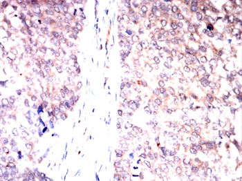 B3GALT4 Antibody