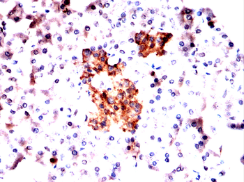 B3GALT4 Antibody