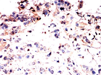 MAP2K5 Antibody