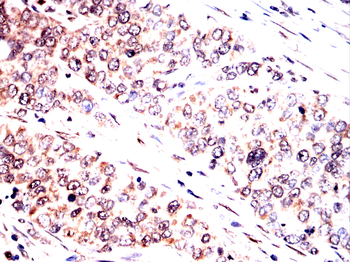 MAP2K5 Antibody