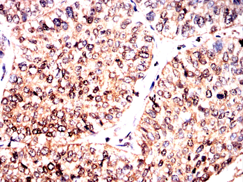 MAP2K5 Antibody