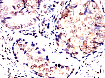 MAP2K5 Antibody