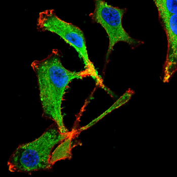 MAP2K5 Antibody