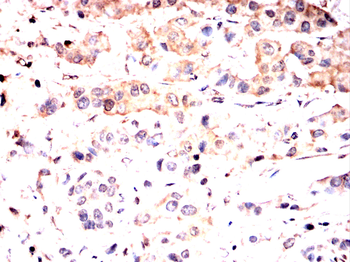 MAP2K5 Antibody