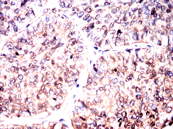 MAP2K5 Antibody