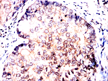 MAP2K5 Antibody