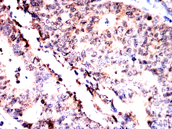 MAP2K5 Antibody
