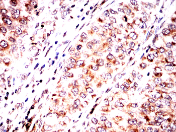 RPTOR Antibody