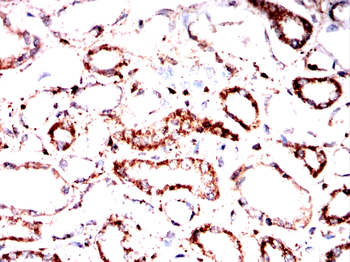 RPTOR Antibody