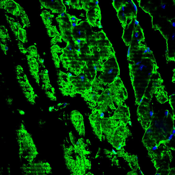 RPTOR Antibody