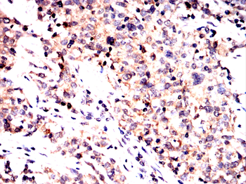 RPTOR Antibody