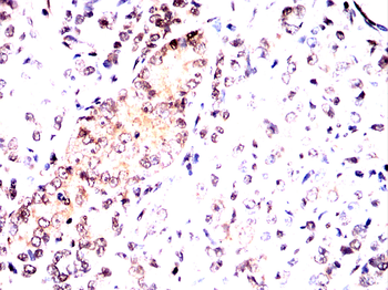 RPTOR Antibody