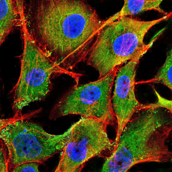PRL Antibody