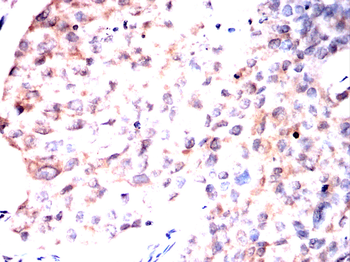 PRL Antibody
