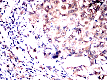 PRL Antibody