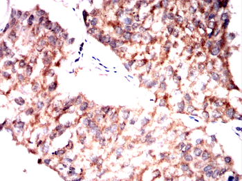 PRL Antibody