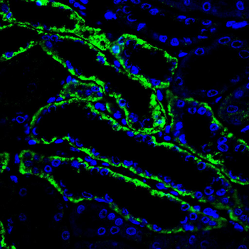 CDH16 Antibody