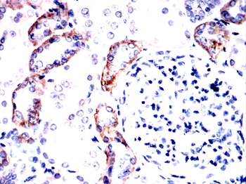 CDH16 Antibody