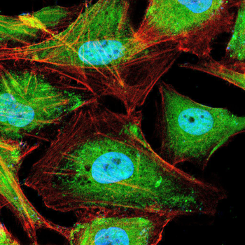 PPP1CB Antibody