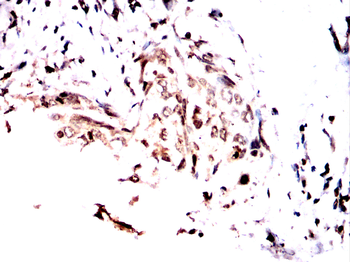 PPP1CB Antibody