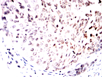 PPP1CB Antibody
