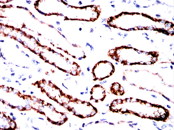CDH16 Antibody