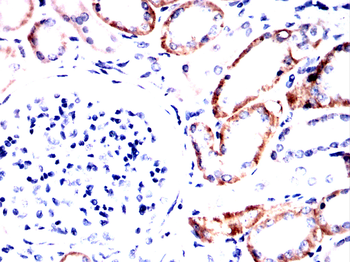 CDH16 Antibody